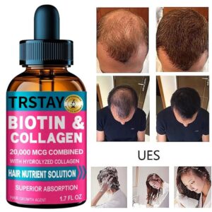 Hairloss Hair Alopecia Hair Treatment  Growth Oil Head Care Growth Spray