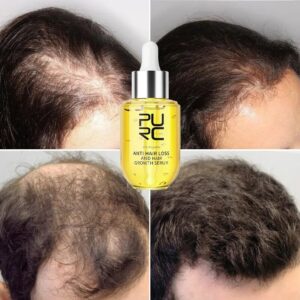 Fast Hair Growth for Men Women Ginger Grow Hair Oil Care Anti Hair Loss Scalp Treatment Serum Products Beauty Health 2023